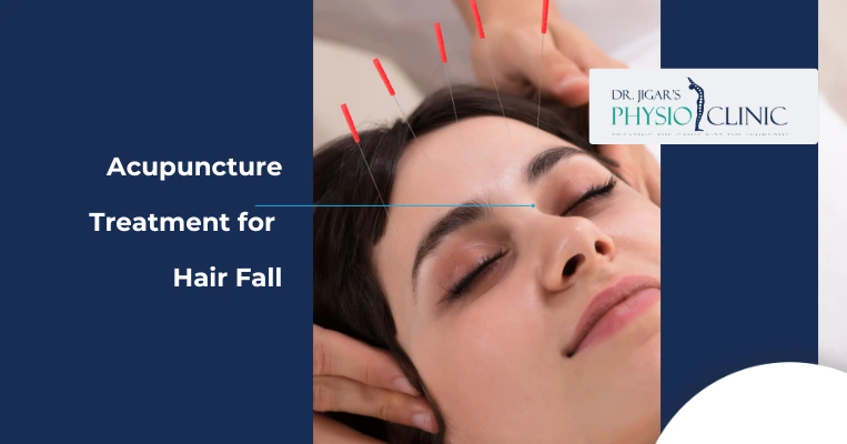  Acupuncture Treatment for Hair Fall 